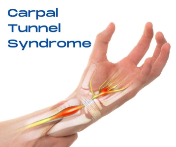 carpal tunnel syndrome